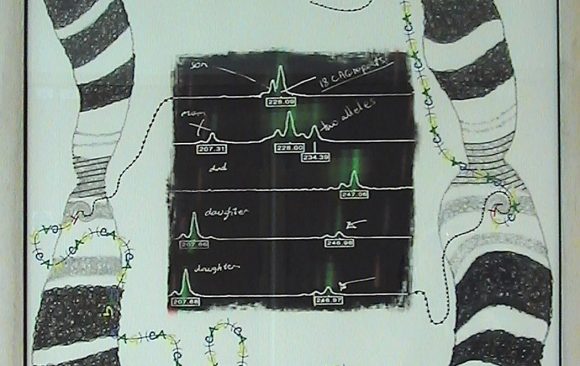 Layered medical image and drawing showing chromosome 'socks' and genetic links