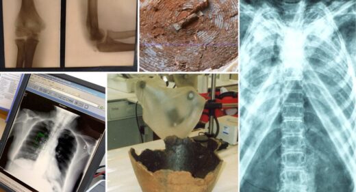 Montage photograph of x-ray images