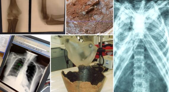 Montage photograph of x-ray images